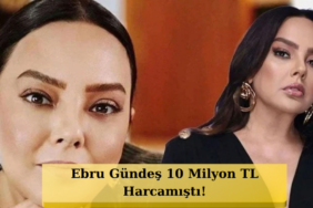 Ebru-Gundes-Estetik-Sonrasi-Gorundu-Degisimi-Dikkat-Cekti-featured