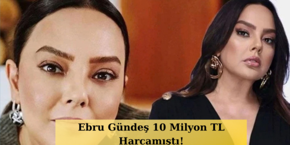 Ebru-Gundes-Estetik-Sonrasi-Gorundu-Degisimi-Dikkat-Cekti-featured