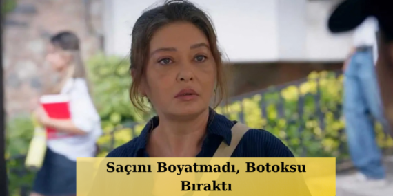 Nurgul-Yesilcay-Omur-Usta-Icin-Botoksu-Birakti-Dogal-Hali-Gundem-Oldu-featured