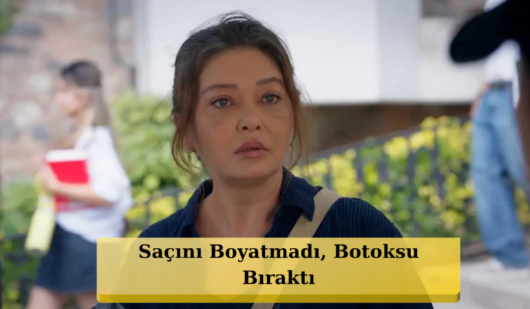 Nurgül Yeşilçay Ömür Usta İçin Botoksu Bıraktı: Doğal Hali Gündem Oldu!