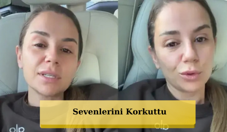 Merve Özbey Merdivenden Düştü, Apar Topar Hastaneye Kaldırıldı: Ünlü Şarkıcıdan İlk Açıklama!