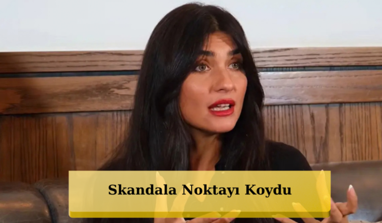 Tuba Büyüküstün'den Olay Yaratan Fotoğraf Sonrası İlk Açıklama: "Kadınların Kılı Var!"